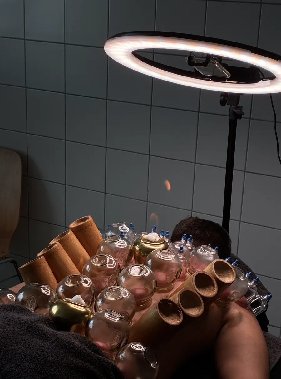 Ventouses en verre, bambou et laiton, avec une flamme