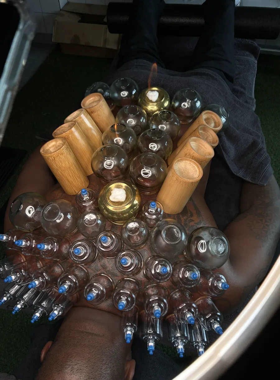 Ventouses en verre, bambou et laiton couvrant tout le dos